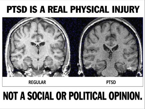 PTSD Brain